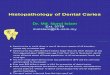 His to Pathology of Dental Dental Caries 1