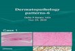 Dermatopathology patterns-6