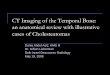 CT Imaging of the Temporal Bone: an anatomical review with 