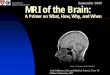 MRI of the Brain: A Primer on What, How, Why, and When
