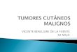 Tumores cutáneos malignos
