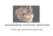 Anatomic landmarks seen in a IOPA