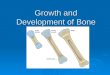 stages of bone formation