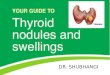 Thyroid nodule evaluation