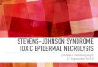 Stevens johnson syndrome & toxic epidermal necrolysis