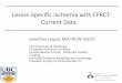 Lesion Specific Ischemia with FFRCT- Current Data