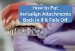 Invisalign Attachments - How to Put It Back in if it Falls Off
