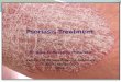 Psoriasis treatment problems in practice