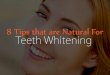 Teeth whitening - 8 tips and tricks naturally