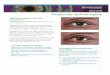 What are pinguecula and pterygium?