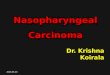 5. nasopharyngeal carcinoma