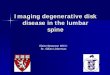 Imaging degenerative disk disease in the lumbar spine