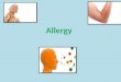Austin Journal of Allergy