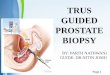 Trus biopsy prostate