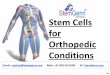 Stem Cells for Orthopedic Conditions