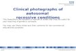 Clinical Photos - Autosomal Recessive conditions