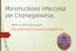 Mononucleosis infecciosa CMV