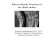 Extra-articular fractures of the distal radius