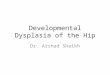 Developmental dysplasia of hip