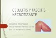 Celulitis y Fascitis Necrotizante