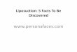 Liposuction: 5 Facts To Be Discovered