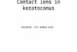 Contact lens in keratoconus 2
