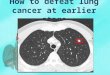 How to defeat lung cancer at earlier stage