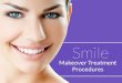 Smile Makeover Treatment Procedures by Wimbledon Dentist