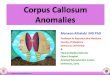 Corpus Callosum  Anomalies