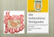 Cáncer intestino delgado