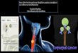 Esophageal squamous Cancer-therapy-Vakalis