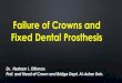 Failure of fixed prosthodontics
