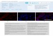 Immunofluorescence Antibody Validation Report for Anti-Cytokeratin 6 Antibody (STJ96982)