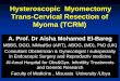 Hyseroscopy myoma resection