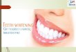 Teeth Whitening - Get Ready for Dazzling Smile!