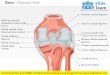 Knee posterior view medical images for power point