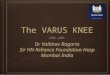 Algorithm to correct Varus Knee in a TKR