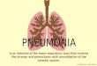 4. pneumonia paediatrics
