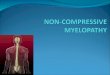 Noncompressive myelopathy