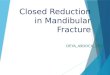 Closed Reduction in Mandibular Fractures