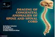 Congenital Anomalies Of Spine And Spinal Cord