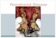 Periodontal Disease. Normal Periodontium Remember which structures make up the periodontium? Healthy gingiva can be pink or pigmented and has a margin