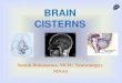 Cisterns of brain
