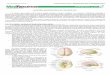 Medresumos 2016   neuroanatomia 13 - anatomia macroscópia do telencéfalo