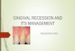 5.gingival recession  seminar