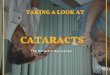Taking a Look at Cataracts