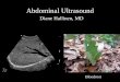 Abdominal Ultrasound - Livingston and Brighton ED Ultrasou… · Sonographic Murphy’s Sign, •A positive sonographic Murphy’s sign, defined as the presence of maximal ... Abdominal