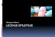 Rašković LEČENJE EPILEPSIJE - pharmacy.frigoplus.co.rspharmacy.frigoplus.co.rs/wp-content/uploads/2013/10/epilepsija.pdf · Inhibitorni uobičajeni mehanizmi odbrane koji ↓ epileptogeno