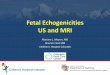 Fetal Echogenicities US and MRI - pedrad Mariana.pdf · Fetal Echogenicities US and MRI Mariana L. Meyers, MD ... Toxo, CMV, Syphillis, Varicella, Parvovirus, HSV II, Rubella –Hemorrhage