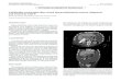 Gallbladder perforation after closed thoracoabdominal ...scielo.isciii.es/pdf/diges/v109n4/imagen1.pdf · 2017, vol. 109, n.º 4 gallbladder perforation after closed thoracoabdominal